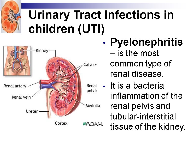 Urinary Tract Infections in children (UTI) Pyelonephritis – is the most common type of